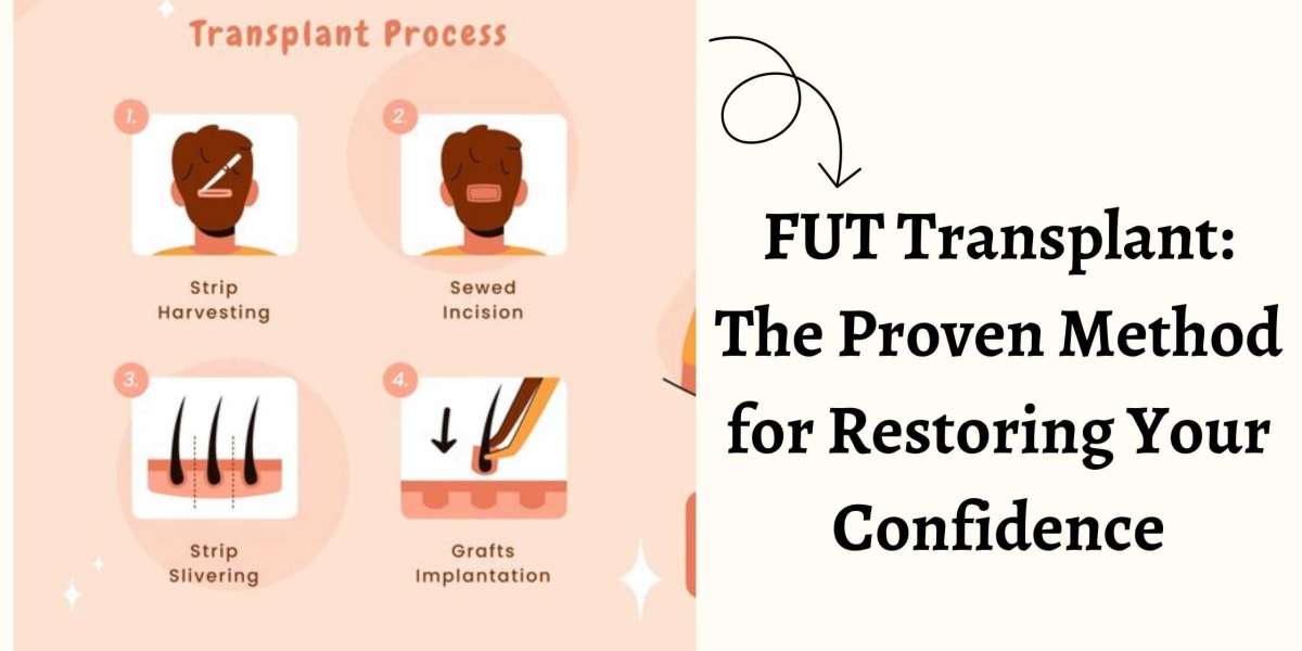 FUT Transplant: The Proven Method for Restoring Your Confidence